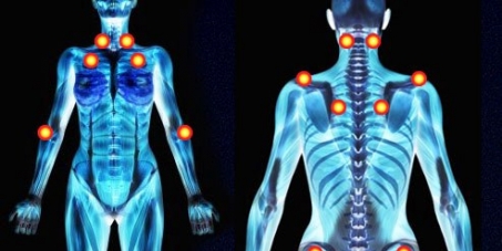 Intuito: Reconhecer que a Fibromialgia é uma doença incapacitante