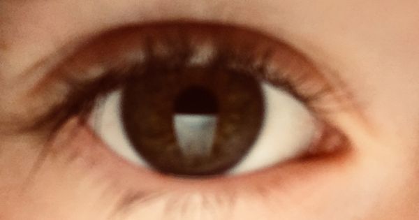 Improve knowledge about autism in girls 